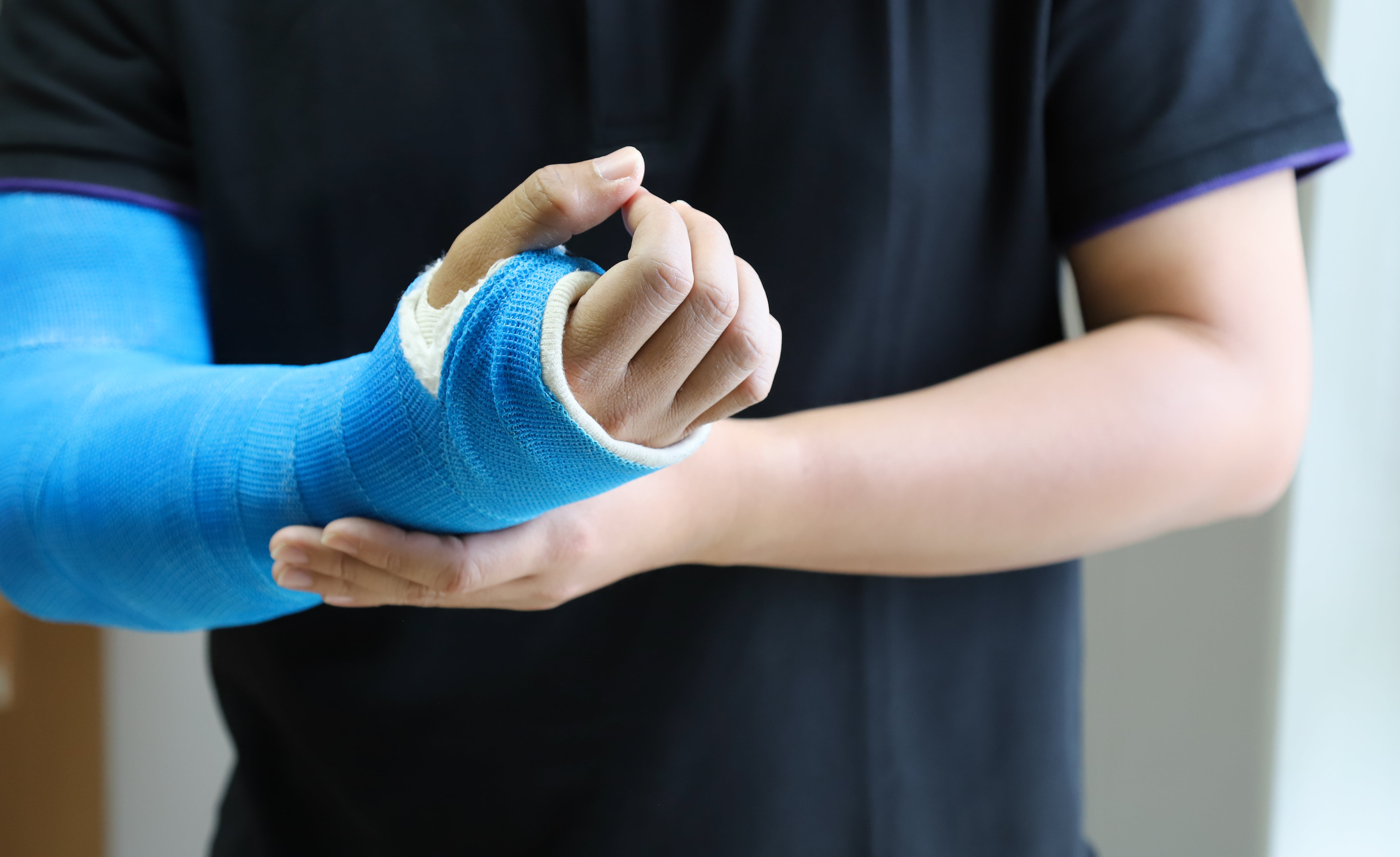 Everything You Need to Know About Arm Casts - cast of josee the tiger and the fish