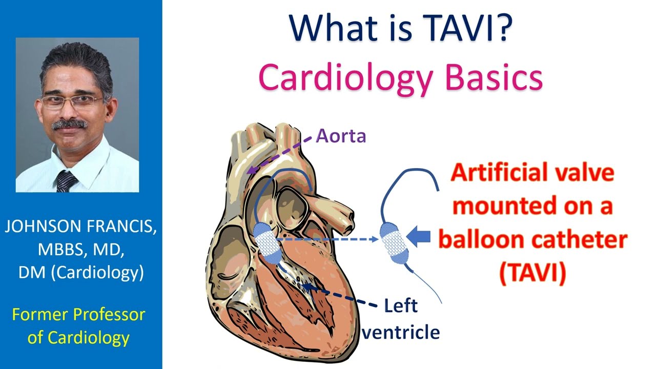 What is TAVI? Cardiology Basics - YouTube - Tavi Baby’s Age on Baddies – Revealed!