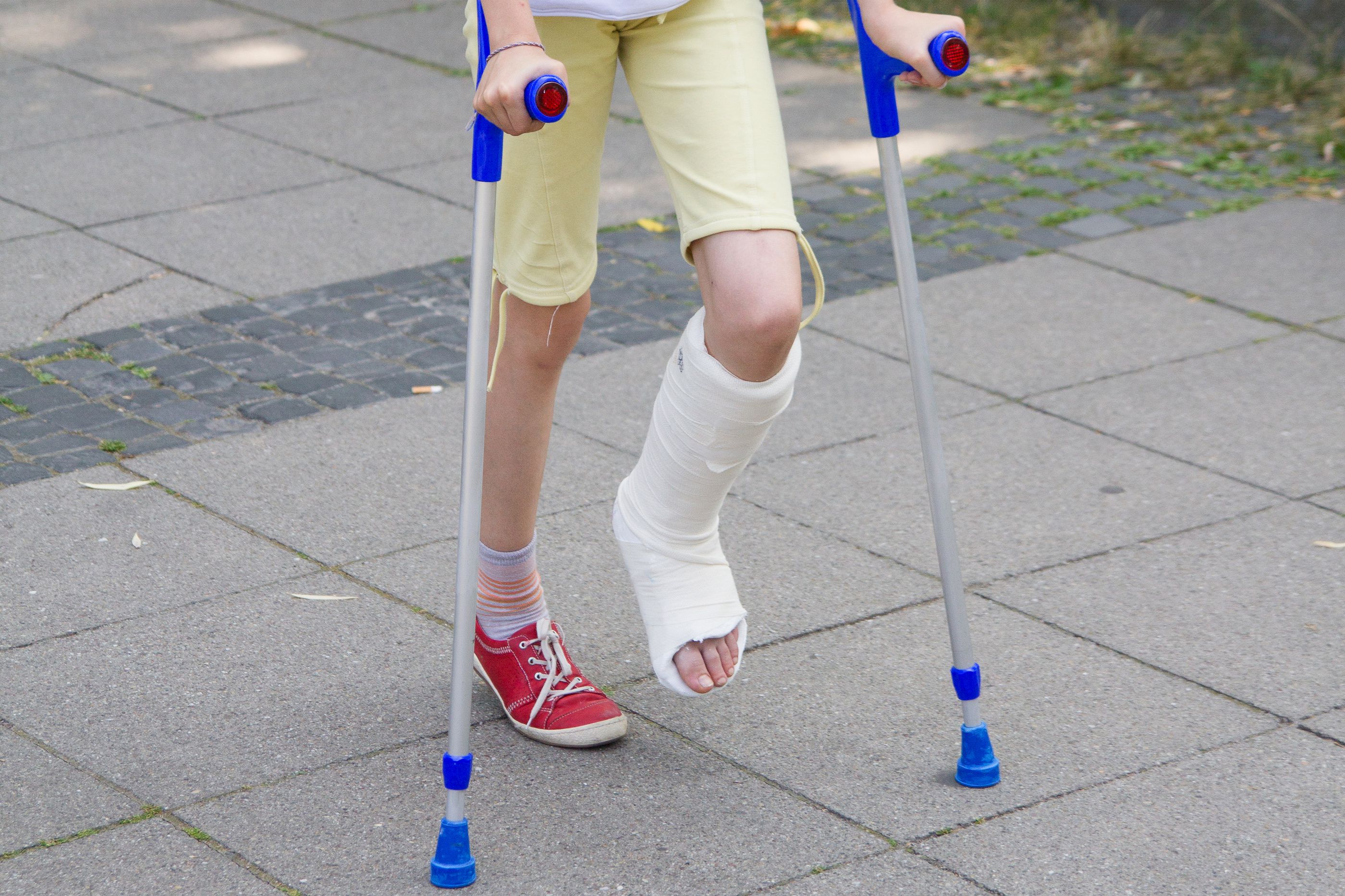 When Your Child Breaks a Bone: Everything You Need to Know About - cast of josee the tiger and the fish